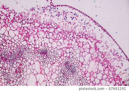 Host cells with spores (mold) are inside wood under the microscope for education. 87691291