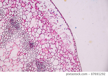 Host cells with spores (mold) are inside wood under the microscope for education. Host cells with spores (mold) are inside wood under the microscope for education. 87691292