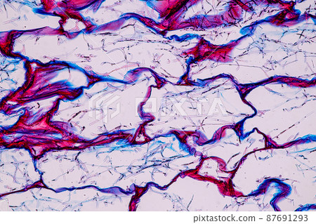 Host cells with spores (mold) are inside wood under the microscope for education. Host cells with spores (mold) are inside wood under the microscope for education. 87691293