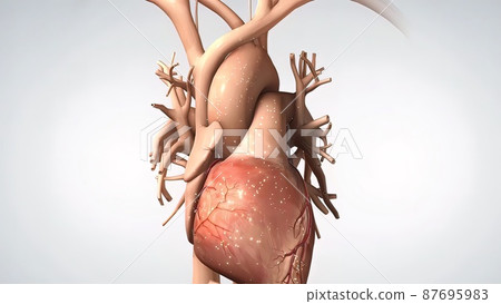 Acute Coronary Syndrome and Heart Attack 87695983