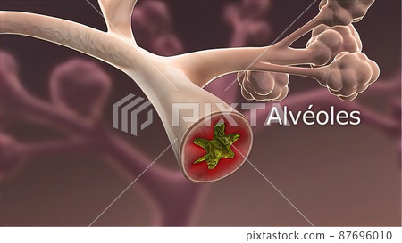 3D Medical illustration Respiratory System, Alveoli 87696010