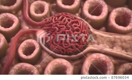3D Medical illustration Respiratory System, Alveoli 3D Medical illustration Respiratory System, Alveoli 87696034