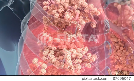 3D Medical illustration Respiratory System, Alveoli 3D Medical illustration Respiratory System, Alveoli 87696047