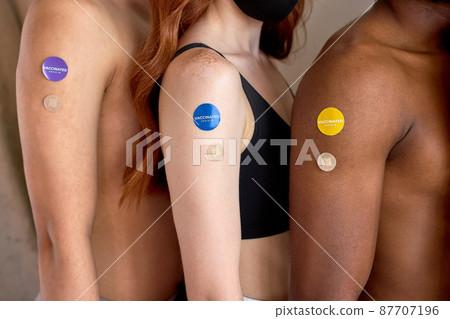 Diverse group of cropped people showing COVID-19 vaccine stickers on arms, close-up Diverse group of cropped people showing COVID-19 vaccine stickers on arms, close-up 87707196