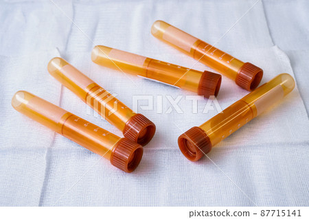 Plastic test tubes with caps for the collection of samples. Blood sampling tubes. 87715141