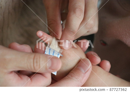 一位母親給一個手指受傷的嬰兒包紮繃帶 一位母親給一個手指受傷的嬰兒包紮繃帶 87727362