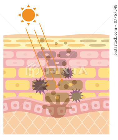 Skin Structure/Skin Structure_UV 87767349