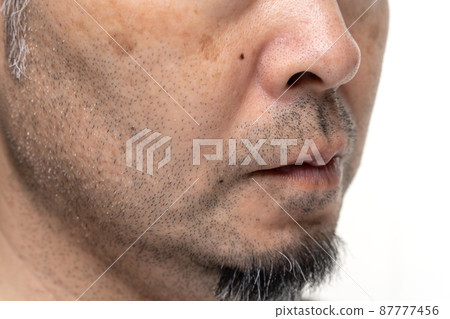 Designer stubble middle man stains pore dirt skin care Designer stubble middle man stains pore dirt skin care 87777456