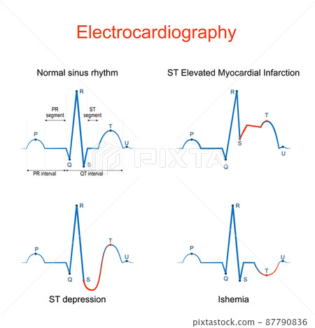 Electrocardiography. ECG or EKG 87790836