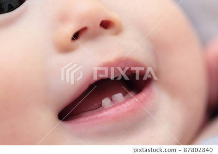 Milk teeth on a 0 year old baby 87802840