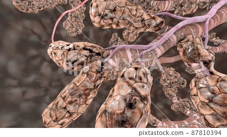 3D medical illustration of pulmonary circulation emphysema 87810394