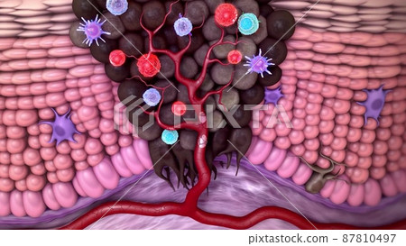 illustrationof skin anotomy.Regulation of NKG2D-Dependent NK Cell Functions 87810497