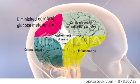 Amyloid Precursor Protein Processing and Alzheimer s Disease 87810712