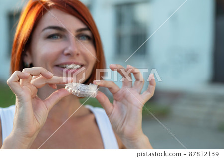 Red-haired Caucasian woman holding transparent mouthguards for bite correction outdoors. A girl with a beautiful snow-white smile uses silicone braces 87812139