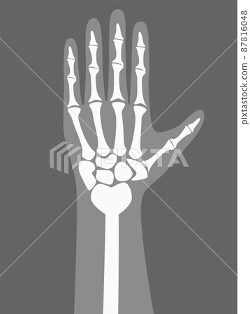 Human Arm Under X-rays Color Vector Illustration Human Arm Under X-rays Color Vector Illustration 87816048
