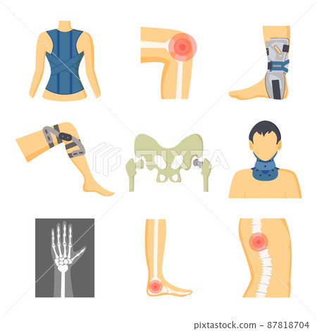 Orthopedics Fixing Tools and Pain in Bones Image 87818704