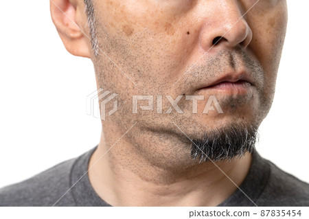 設計師留茬中間人污漬毛孔污垢護膚 87835454