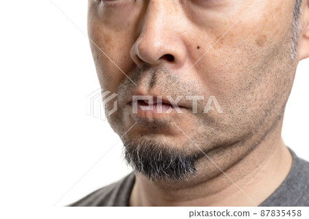 設計師留茬中間人污漬毛孔污垢護膚 87835458