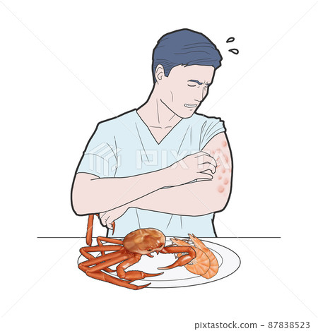 Hives Symptoms Description Medical Illustration 87838523