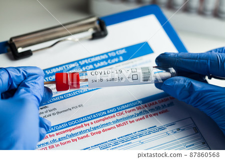 rt-PCR COVID-19 virus disease diagnostic test 87860568