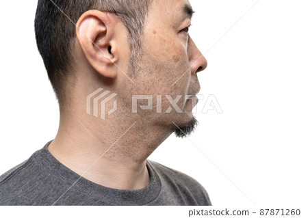 中年男性有胡茬污漬、毛孔污垢、皮膚護理、用面具揉耳朵 中年男性有胡茬污漬、毛孔污垢、皮膚護理、用面具揉耳朵 87871260