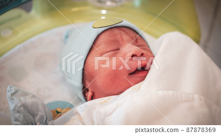 A wound on the newborn's forehead caused by a scalpel in the delivery room. A wound on the newborn's forehead caused by a scalpel in the delivery room. 87878369