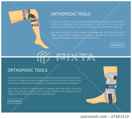 Orthopedic Tools Fixators Set Colorful Poster Orthopedic Tools Fixators Set Colorful Poster 87881019