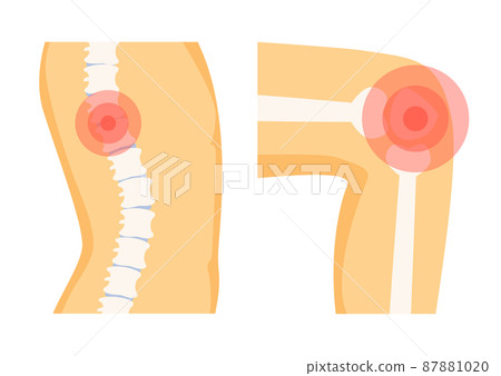 Spine Orthopedic Pain Set, Vector Illustration 87881020