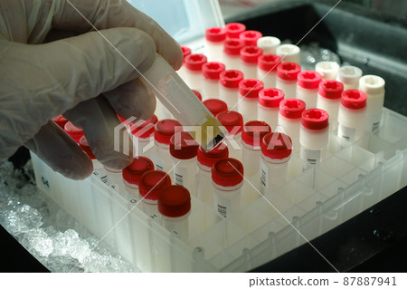 medical specimen 87887941