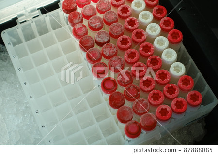 medical specimen 87888085