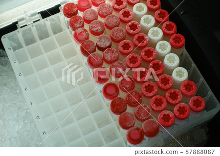 medical specimen 87888087