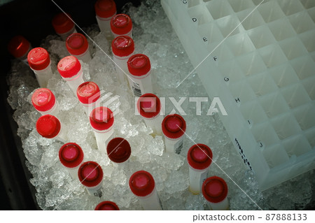 medical specimen medical specimen 87888133