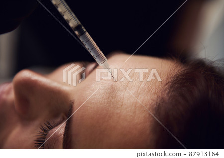 Close-up of the face of a woman getting a beauty injection on the forehead. Anti-aging, rejuvenating treatment, skin care concept. 87913164