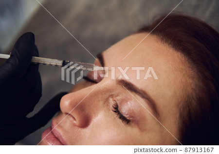 Beautiful middle aged European woman getting beauty injections on her face in wellness spa cosmetology clinic. Botulinum toxin injection and hyaluronic acid for anti-wrinkle anti-aging therapy 87913167