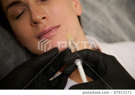 Close-up of the face of a beautiful Caucasian woman receiving a beauty injection of hyaluronic acid on her face for smoothing and rejuvenating. Anti-aging therapy and skin care concept. Wellness spa 87913171