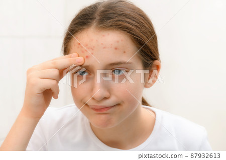 a disappointed teenage girl looks in the mirror at her face with pimples, touches her face, she is upset and has bad emotions a disappointed teenage girl looks in the mirror at her face with pimples, touches her face, she is upset and has bad emotions 87932613