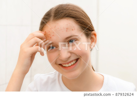 a positive teenage girl looks in the mirror at her face with pimples, touches her face, she is happy and has good emotions a positive teenage girl looks in the mirror at her face with pimples, touches her face, she is happy and has good emotions 87932624