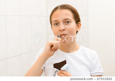 face of a teenage girl with pimples, acne on the skin, she looks at herself in the mirror and eating a chocolate, concept of beauty and health 87932682