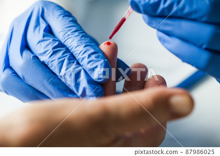 Medical technician EMS doctor taking finger prick PRP patient blood sample using pipette 87986025