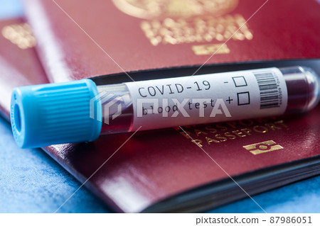 COVID-19 test tube and red passport 87986051