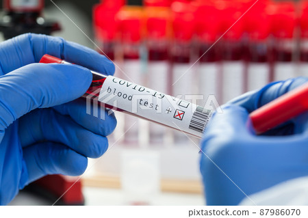 Lab scientist medical technologist labelling blood sample test tube vacutainer Lab scientist medical technologist labelling blood sample test tube vacutainer 87986070