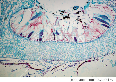 Longitudinal section of liverwort cup-shaped microscopic image 87988179