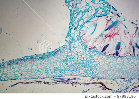 Longitudinal section of liverwort cup-shaped microscopic image 87988180