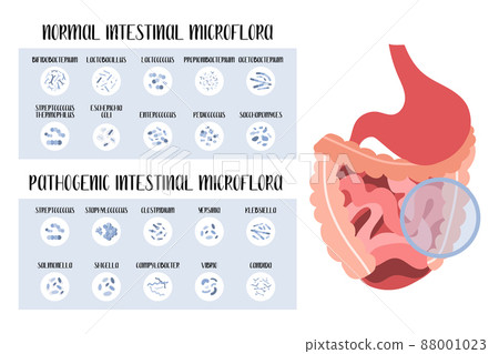 Intestinal microflora. Normal and pathogenic... - Stock Illustration ...