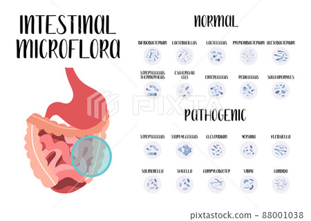 Intestinal microflora. Normal and pathogenic bacteria for stomach, gut, intestine. Good and bad microorganism. Microbiome. Vector flat cartoon illustration. Perfect for flyer, medical brochure, banner Intestinal microflora. Normal and pathogenic bacteria for stomach, gut, intestine. Good and bad microorganism. Microbiome. Vector flat cartoon illustration. Perfect for flyer, medical brochure, banner 88001038