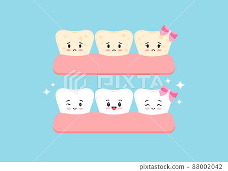 Cute tooth whitening and tooth with yellow plaque before, after icon set. 88002042