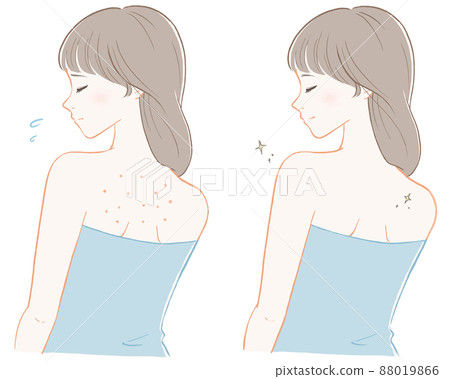 Women who care about their backs before and after 88019866