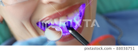 Young woman treating teeth with cordless LED curing light machine closeup 88038751
