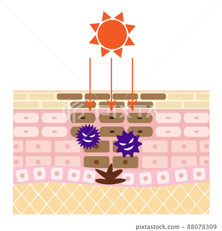 粗糙皮膚的橫截面。由紫外線引起的污漬的圖像。 88078309