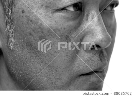 中年男人臉上長斑 眼睛下垂 88085762